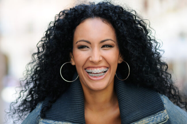 Adult-Orthodontics And Non-Surgical-Palatal-Expansion